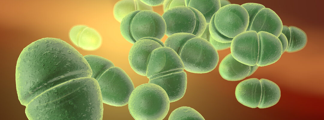 Enterococcus faecium