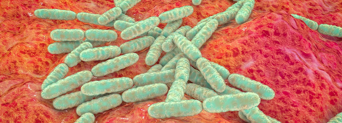 Lactobacillus acidophilus