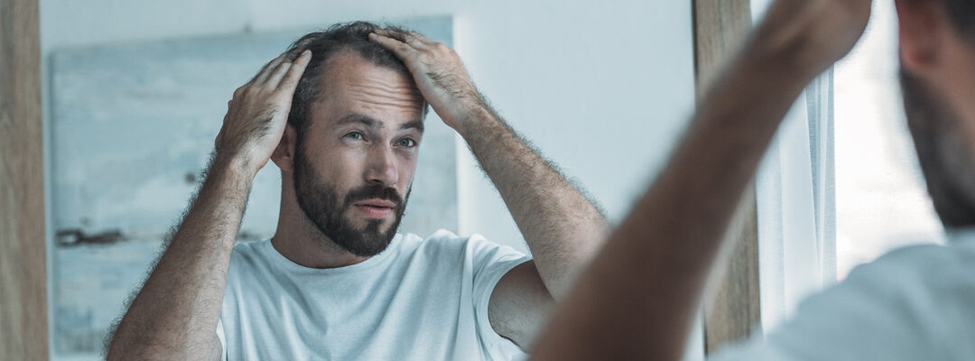 Minoxidil Sulfato