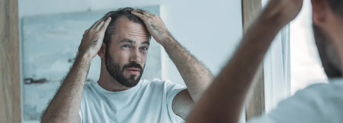 Minoxidil Sulfato Minoxidil Sulfato